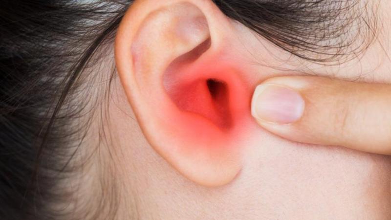 Kulakta Sedef Hastalığı